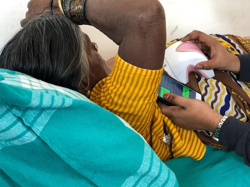 NIRAMAI's Thermalytix handheld device in use at a screening camp with phone app visible