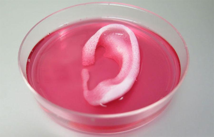 Alt text: 3D bioprinted ear tissue construct 85 layers