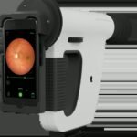 Remidio Insta FOP NM-10 handheld non-mydriatic fundus camera