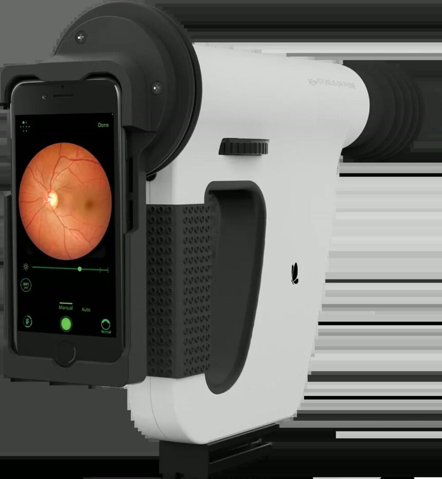 Remidio Insta FOP NM-10 handheld non-mydriatic fundus camera