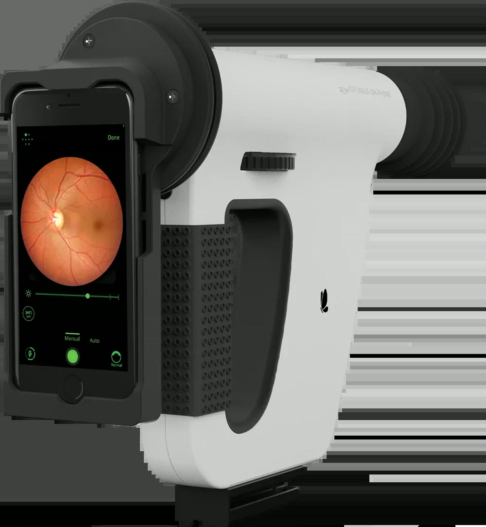 Remidio Insta FOP NM-10 handheld non-mydriatic fundus camera