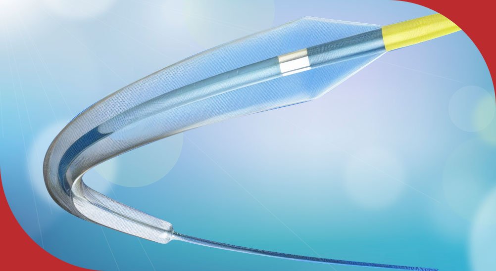S3V Vascular's balloon catheter, part of the company's indigenous neuro-intervention device portfolio