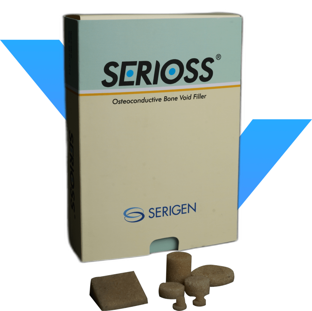 Serioss silk-protein bone void filler by Serigen Mediproducts