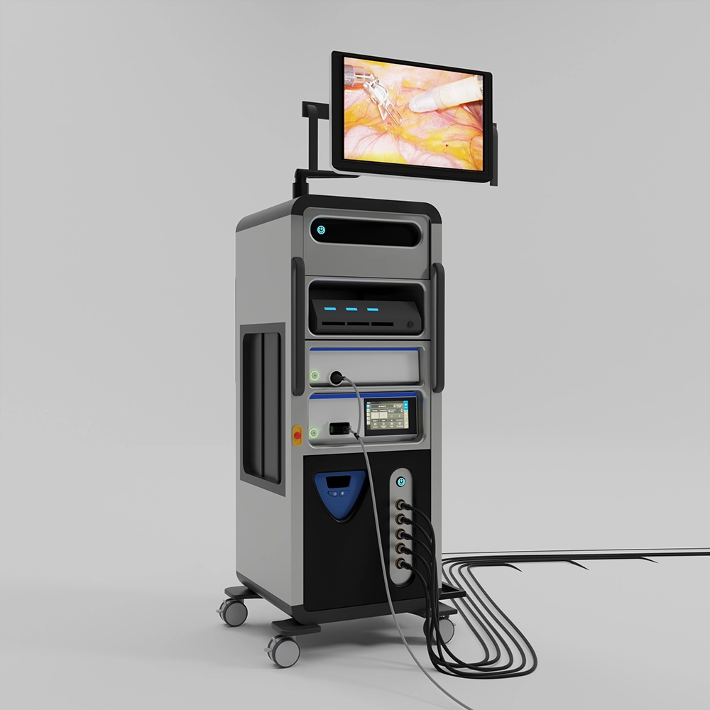 The SSi Mantra 3 vision cart giving the operating-room team a magnified 3D 4K view